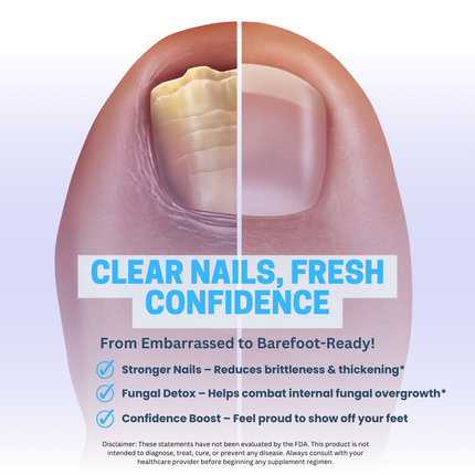 Fungus Exodus The Clear Nail Formula Pills, Fungus Nails Probiotic - 2 Pack